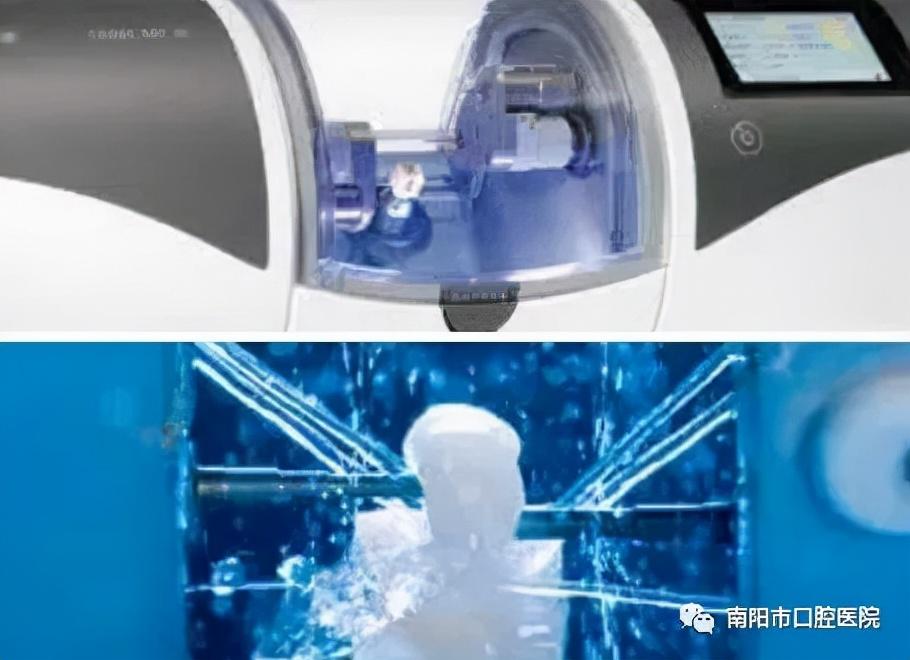 嵌体修复价格的奥秘，牙齿的奇妙之旅与修复小秘密探索